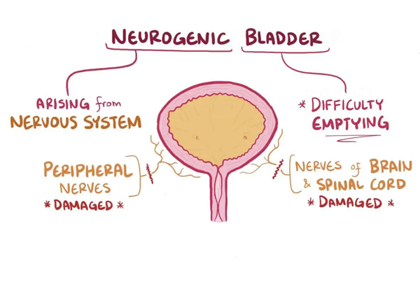 Neurogenic Bladder