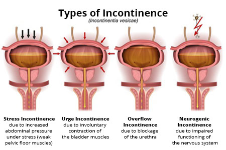 Incontinence